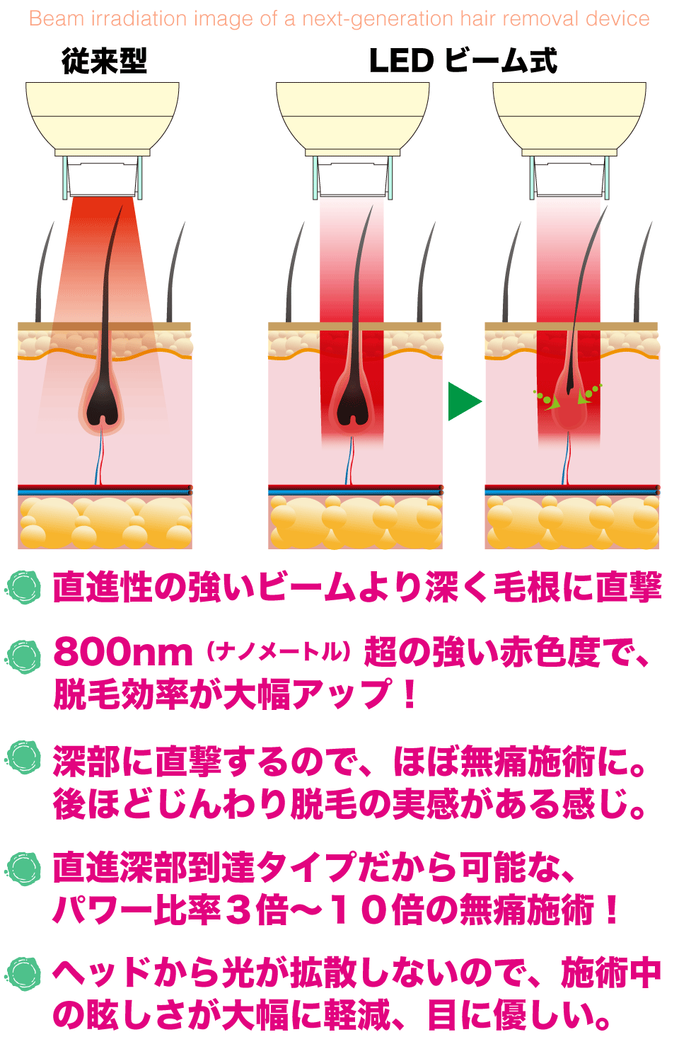 LED脱毛器、LED美顔器　ステーシー　LED説明