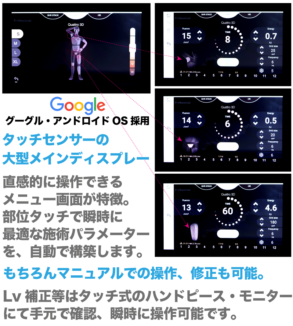 PRO用最高級LED脱毛器　W50　アンドロイドOS